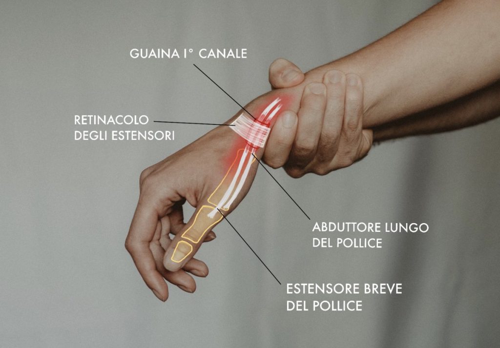 anatomia De Quervain